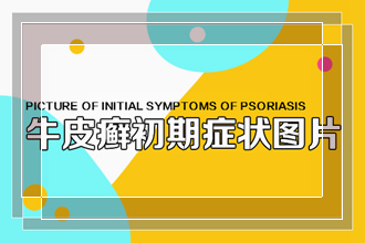 饮食方面能够帮助治疗我多年来的牛皮癣吗
